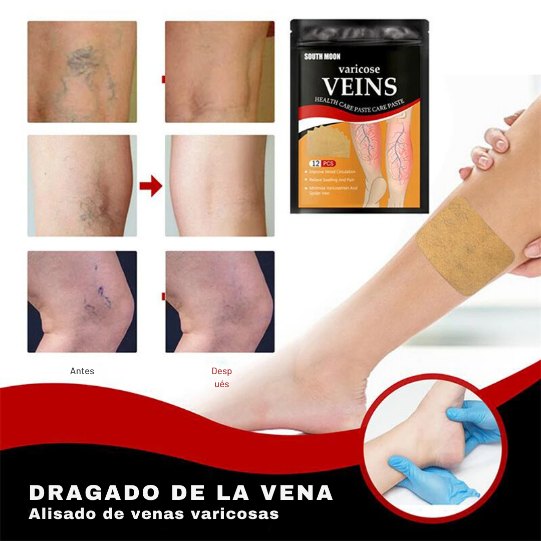 ¡SUPER OFERTA! Pack 2X1 Parches para varices